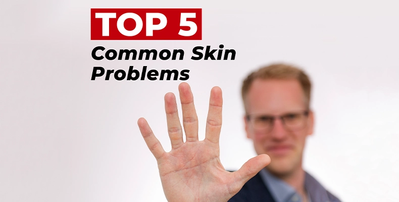 Top 5 Common Skin Problems